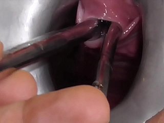 Amateur FreyjaAnalslut:  Multiple Sounds - James is stretching Freyja's urethra with multiple sounds - peeing into Freyja's gaping cunt