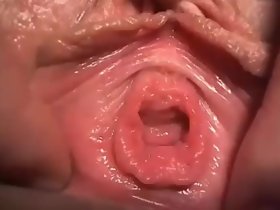 Pat my opening