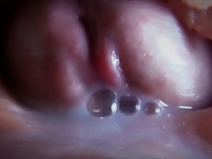Unsophisticated insemination