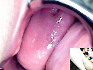 Adalynnx - endoscopio especulum hitachi vibrator cum
