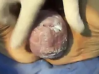 Coño de sneezles abuela