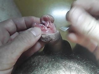 भेदी और subincision